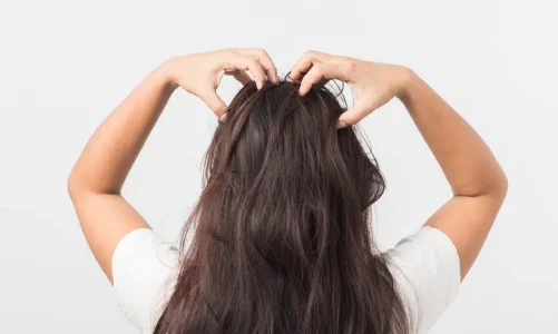 Hoe een shampoo voor vettig haar kan helpen bij een jeukende hoofdhuid